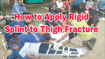 How to Apply Rigid Splint to Thigh Fracture #splint
