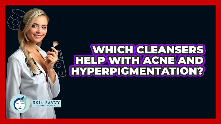 Which Cleansers Help With Acne And Hyperpigmentation? - Skin Savvy Dermatology