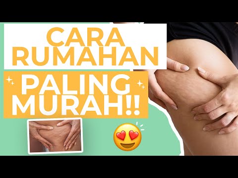 Video: 3 Cara Membantu Membuat Selulit Kurang Terlihat