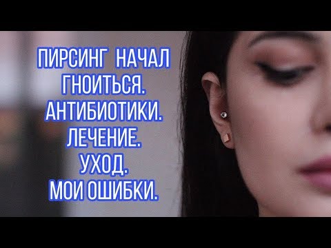 ПИРСИНГ УХА! Лечение! Загноился прокол