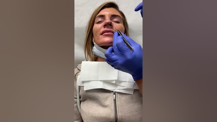Rhinoplasty - Splint Removal | Dr. J. J. Wendel Plastic Surgery