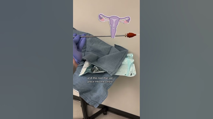 #hysterosalpingogram #HSG #fertilitytest #shorts