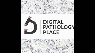 153: Can GPT-4o Classify Tumors Better Than Us? AI-Powered Pathology Insights