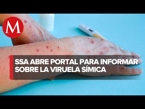 Síntomas y medidas de prevención: Gobierno abre portal sobre viruela del mono