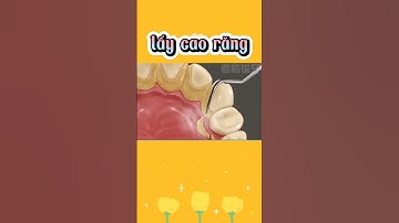 lấy cao răng #thegioithuvi #bietthemmotchut
