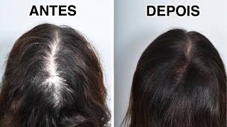 Como Acabar com a Queda de Cabelo sem Gastar Nada