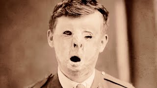 8 People Who Survived The Impossible
