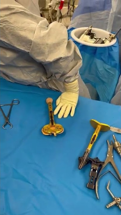 Measuring for a total knee replacement