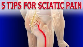 FIVE Simple Strategies To Alleviate Sciatic Nerve Pain | Taught By A Physical Therapist