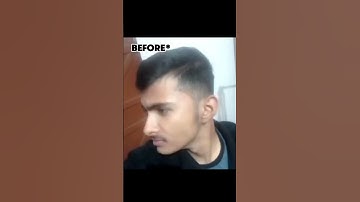 Reverse thumb pulling exercise #looksmaxxing #faceexercise