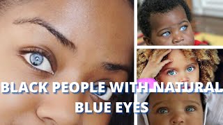 Black People with Natural Blue Eyes - Is it Possible? by Life with Dr. Trish Varner 20,224 views 2 years ago 15 minutes
