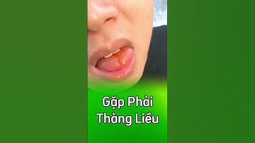 Cây bẫy kẹp gặp phải thằng liều 🤣🤣🤣  #câybắtmồi  #câybẫykẹp