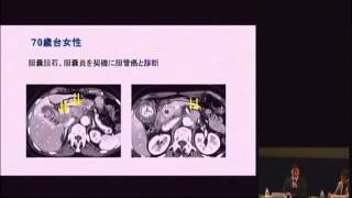 もっと知ってほしい　がんと化学療法のこと　古瀬 純司