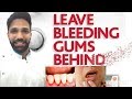 How to cure Bleeding gums | मसूड़ों से खून को कैसे ठीक करें | Tips for healthy gums