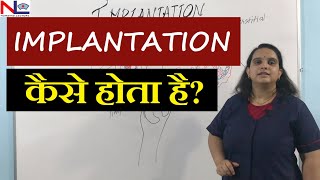 Implantation in Hindi | Placenta development [ Part-1 ] Nursing lecture