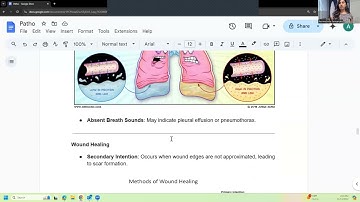 Pathophysiology Midterm Review - Understanding Key Concepts
