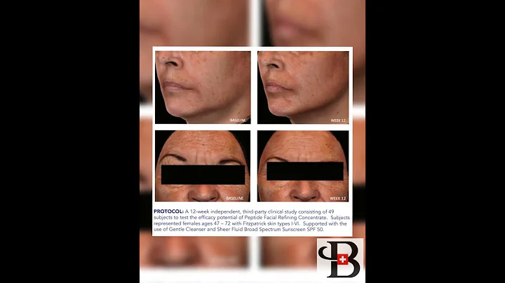 ZO Skin Health – Peptide Facial Refining Concentrate Serum (30ml)