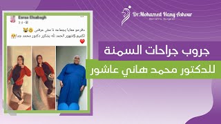 جروب جراحات السمنة - الدكتور/ محمد هاني عاشور