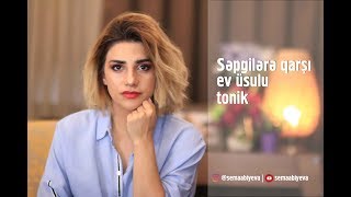 Səpgi və sızanaqlara qarşı ev üsulu tonik