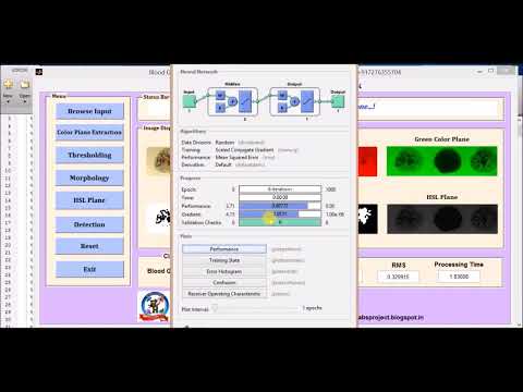 Detection of Blood Group Type Using Neural Network | Source Code | Matlab Project Code