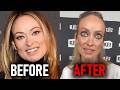 Ozempic Is Making These Celebrities Look DECADES Older Before After Transformations 