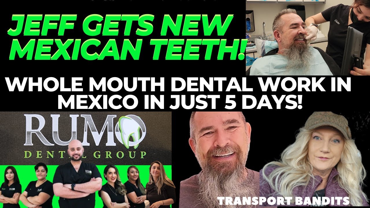 Jeff Gets New Mexican Teeth! Whole Mouth Dental Work Mexico! YouTube
