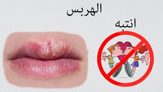 herpes simplex virus/ ما هو فيروس الهربس و كيف نصاب به