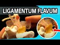 Ligamentum flavum  the first dynamic ligamentum flavum ever to be produced