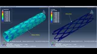 Abaqus Stent Graft Opening Simulation