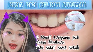 CARA PASANG GIGI KELINCI DIRUMAH‼️AMAN GA❓