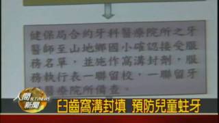 20100209臼齒窩溝封填 預防兒童蛀牙