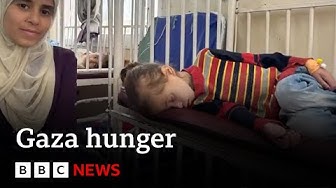 BBC exclusive US doctors shocking video from frontline hospital in Gaza BBC News