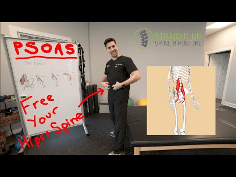 Is A Tight Psoas Muscle Causing Your Low Back or Hip Pain? Stretches & Exercises For Hip Flexors.