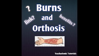 Role of orthosis in burns Rehabilitation | Benefits of orthosis in burns | Teachademic Tutorials