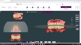 Teeth Setup Tutorial