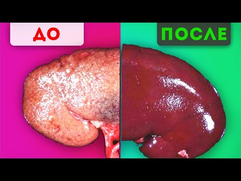 Ты этого не ЗНАЛ! Просто добавь яблочный уксус в…