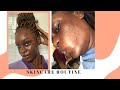 HOW TO GET RID OF PIMPLES + ACNE AT HOME I ACNE TREATMENT