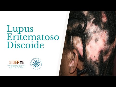 Revisión Lupus Eritematoso Discoide