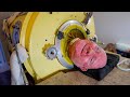 He was locked in this capsule for almost 70 years. The story of the last man in an “iron lung”