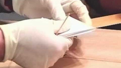 Collection Procedures for Fingernail Scrapings