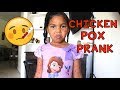 Chicken pox prank on 4 years old sister   very funny 