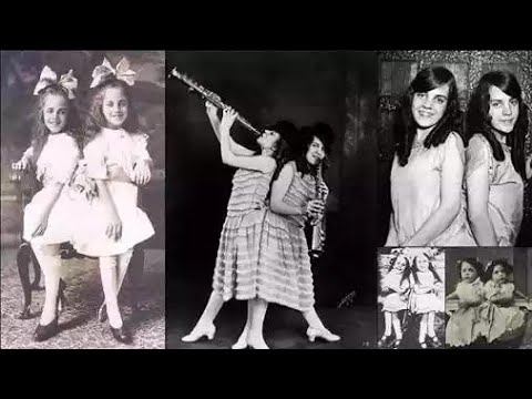 Daisy And Violet Hilton Sisters Rock The Show Facts Kedavra