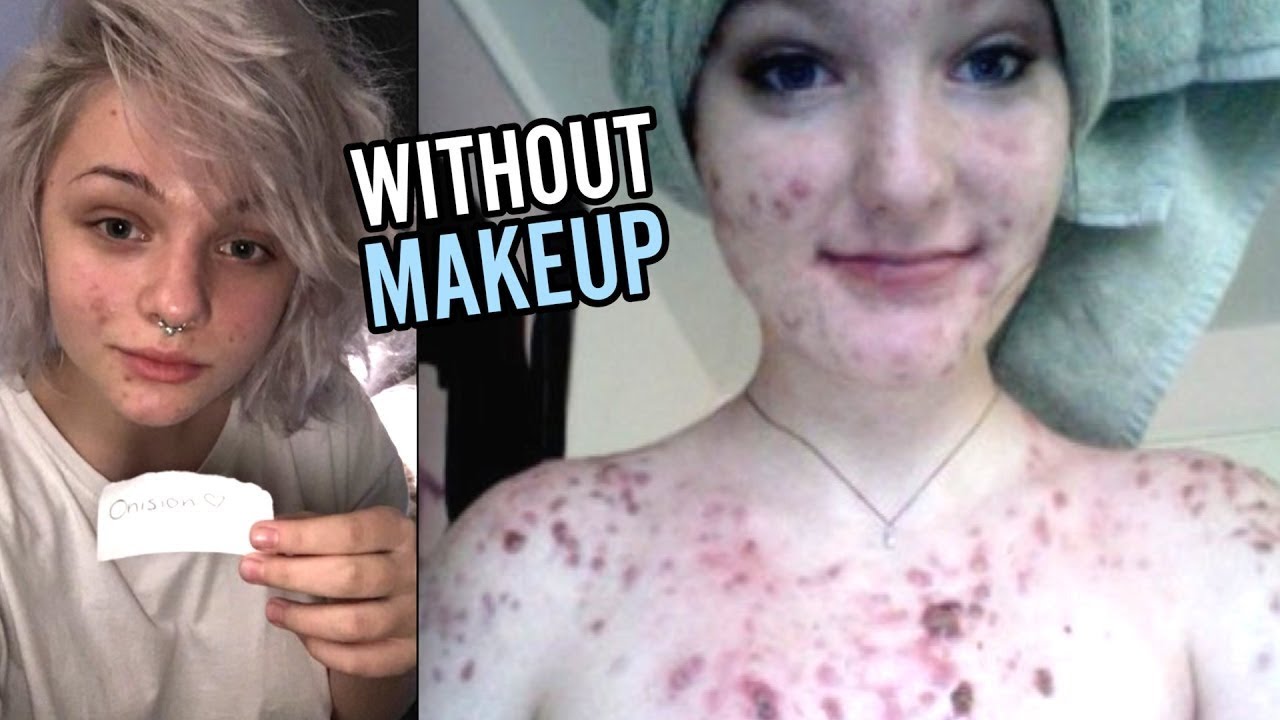 GIRLS WITHOUT MAKEUP No Makeup Whatsoever YouTube