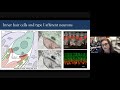 2020 Hyperacusis Webinar: Inner Ear Mechanisms of Hyperacusis with Pain