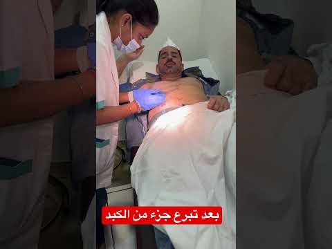 الأخ ضياء بعد تبرع الكبد