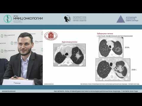 Туберкулез и рак легкого – возможности дифференциальной диагностики