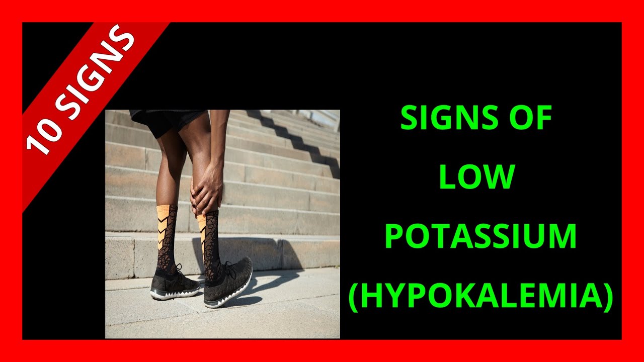 10 Signs Of Low Potassium Symptoms And Causes Youtube