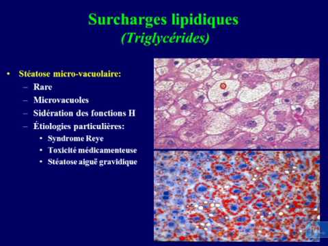 Vidéo: L'efficacité Des Interventions De Soins De Santé Non Pharmacologiques Pour La Gestion De L'asthme Pendant La Grossesse: Une Revue Systématique