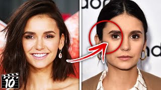 Top 10 Celebrities Who Look WORSE After Plastic Surgery