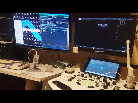Vista previa del video: Ver Worklist DICOM